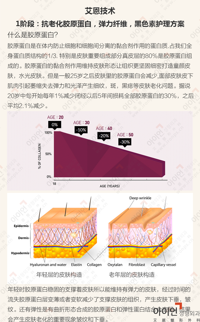 艾恩提升