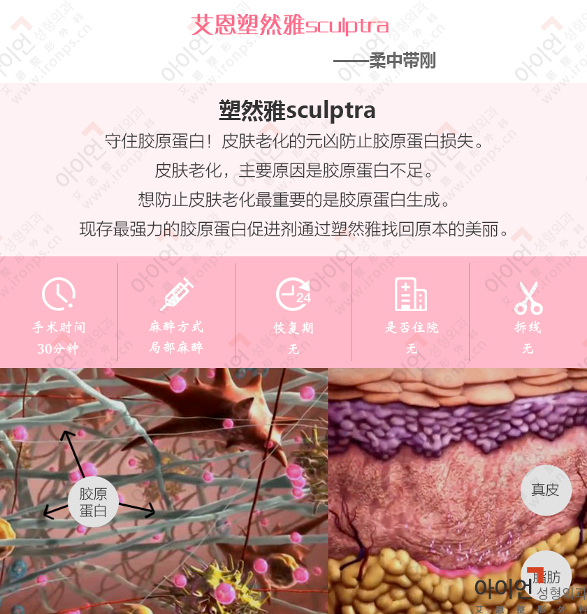 塑然雅sculptra