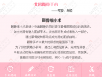 颧骨手术