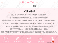 V-line手术